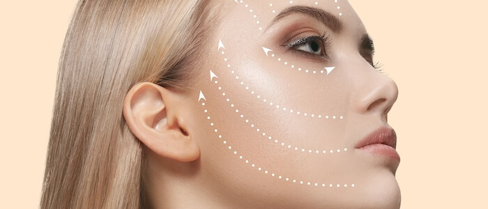 Sıvı Yüz Germe Nedir?