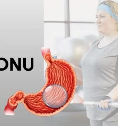 Allurion Mide Balonu