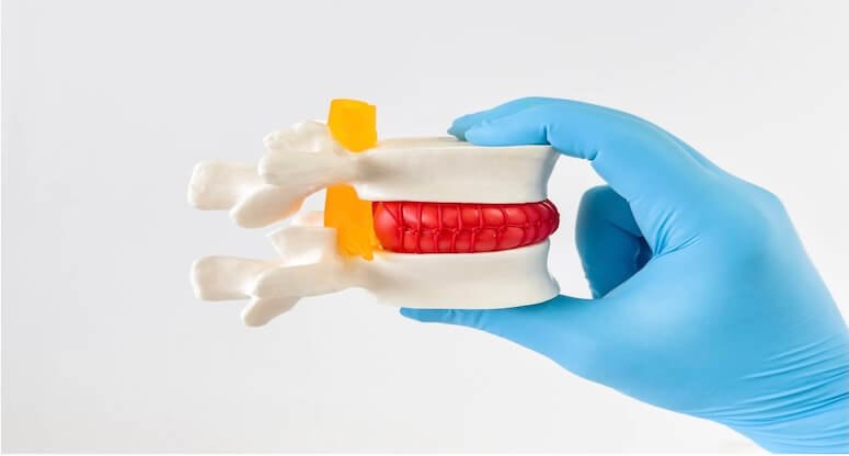 Omurga Kırığı Nedir? Belirtileri, Nedenleri ve Tedavisi