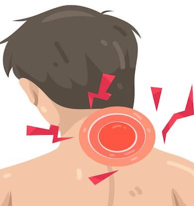 Sigara Kullanımı ve Boyun Fıtığı: Bilimsel Çalışmalardan Çarpıcı Bulgular