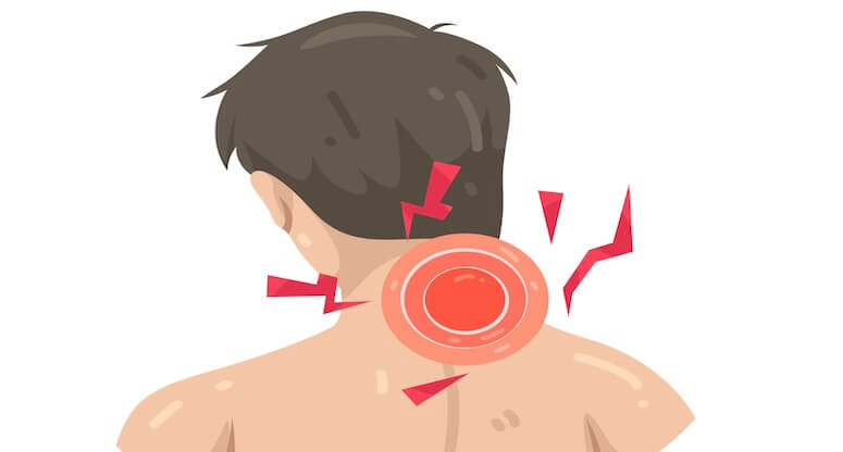 Sigara Kullanımı ve Boyun Fıtığı: Bilimsel Çalışmalardan Çarpıcı Bulgular